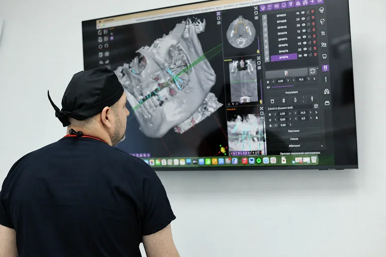Prezentarea analizei implantologice 3D pe ecran mare la MoldDent Orhei