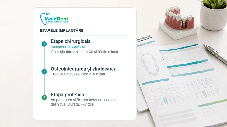 Calendarul etapelor tratamentului implantar MoldDent Orhei