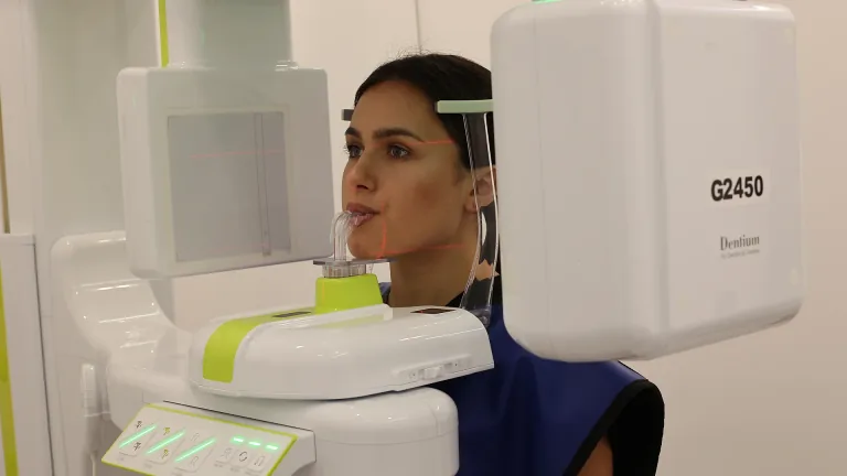 Tomografie computerizată 3D dentară la MoldDent Orhei